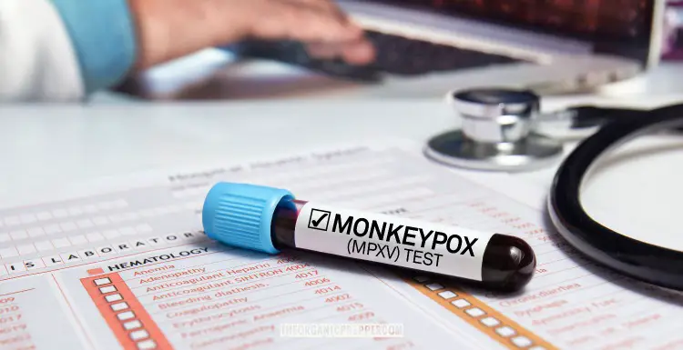 What Preppers Need to Know About Monkeypox